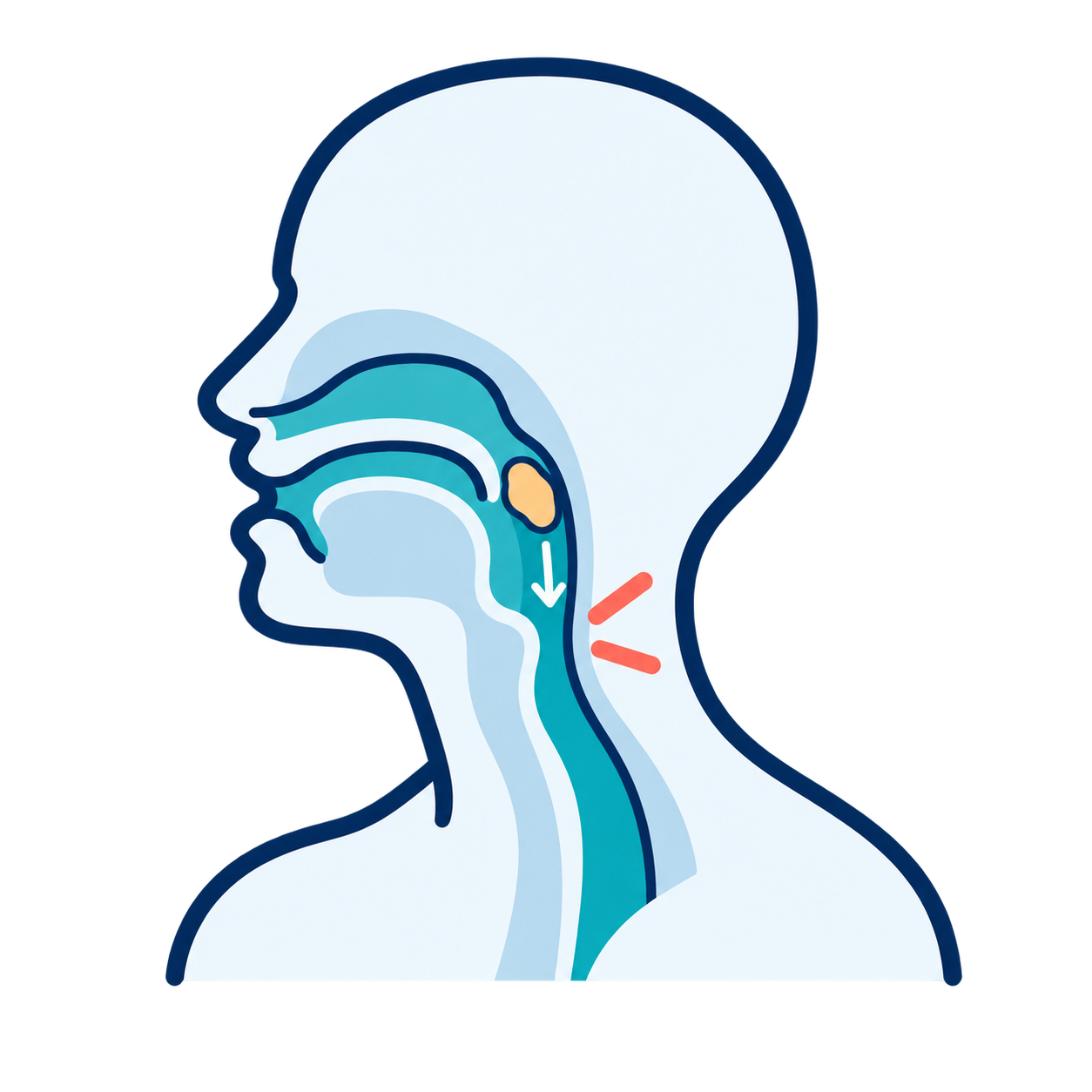 Difficulty swallowing